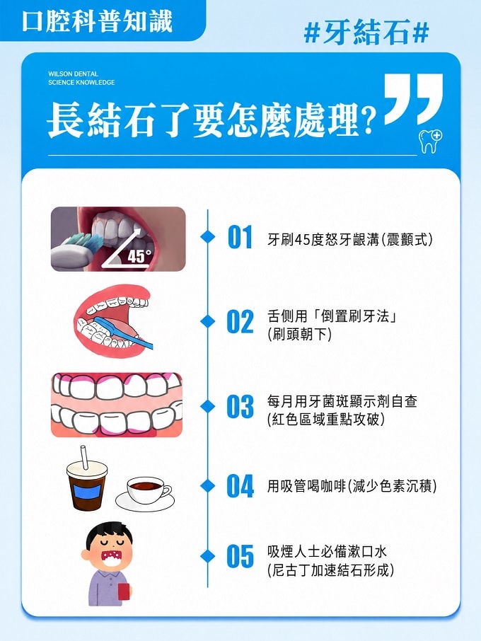 長結石了要怎麼處理