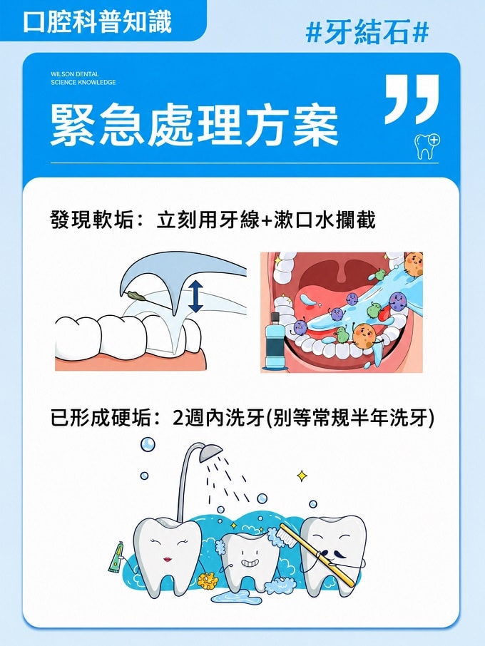 牙結石緊急處理方案