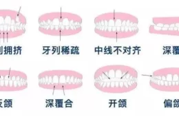 30而已，40正好，50了还能矫正牙齿吗