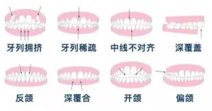 牙齿问题
