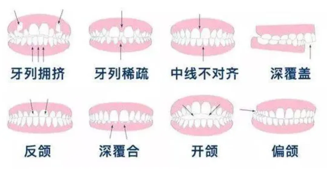 牙齿问题