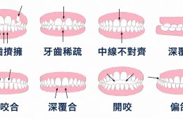 30而已，40正好，50了還能矯正牙齒吗
