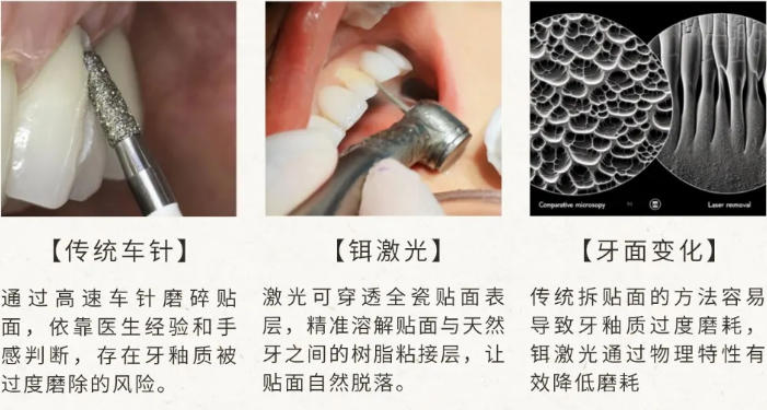 拆貼面方式對比